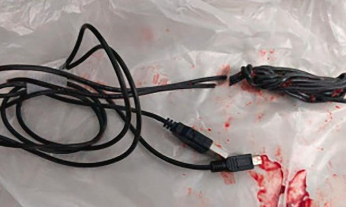 The Boy Who Put A Usb Cable In His Anus You Will Be Shocked To Know What Happen-TeluguStop.com