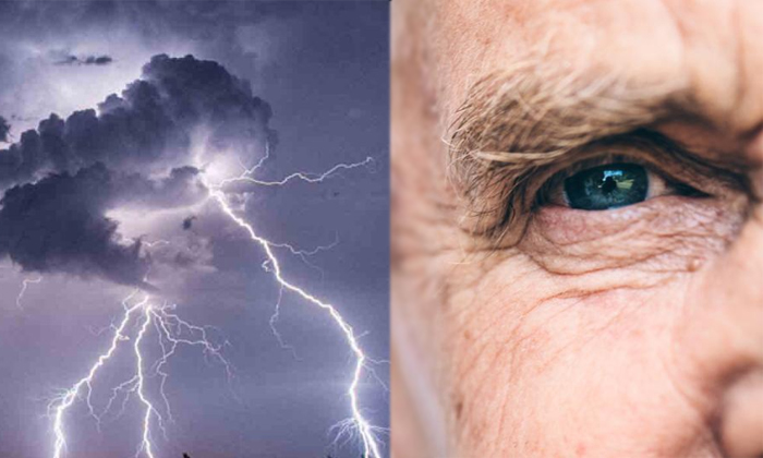  A Man Gets His Eye Sight Back With A Thunderbolt Details, Eye Sight , Thunderbol-TeluguStop.com