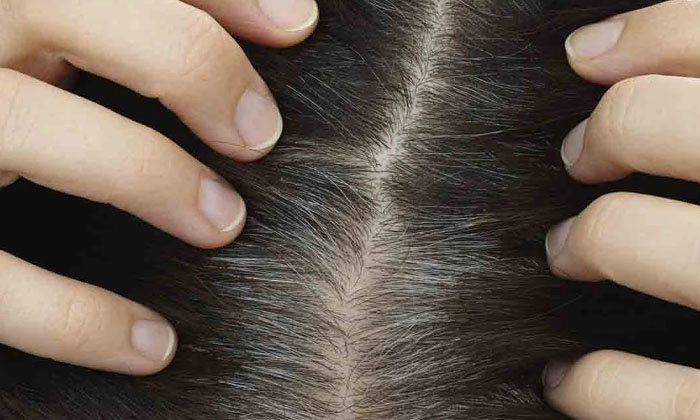  This Effective Pack Will Turn Your White Hair Black Naturally! Hair Pack, Black-TeluguStop.com
