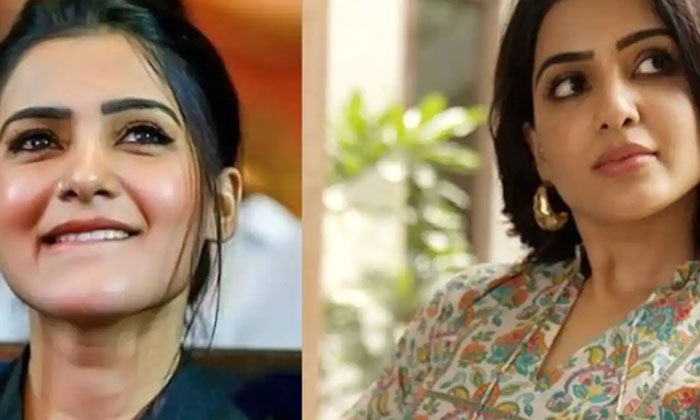 Telugu Samantha, Skin Problem, Tollywood-Movie Telugu Samantha, Skin Problem, Tollywood-Movie