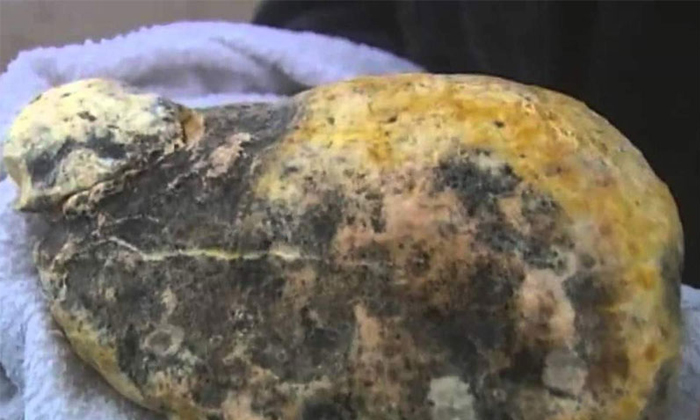 Telugu Ambergris, Amount, Latest, Whale Vomit-Latest News - Telugu