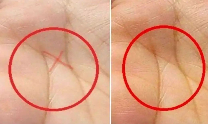  Do You Know What Happens If You Have This Mark On Your Palm Details, Palm, Astro-TeluguStop.com