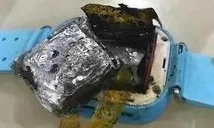  Apple Shocked The Users The Smart Watch Exploded Like A Bomb-TeluguStop.com