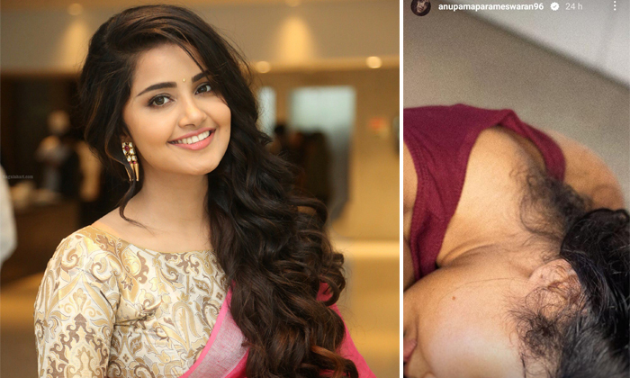  Anupama Parameswaran Who Showed The Birthmark With That Photo Details, Anupama-TeluguStop.com