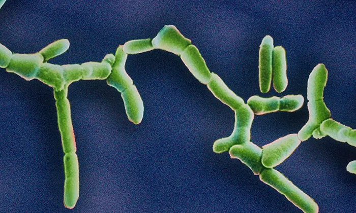  Deadly Listeria Infection Reported In 6 American States , Listeria, American Sta-TeluguStop.com