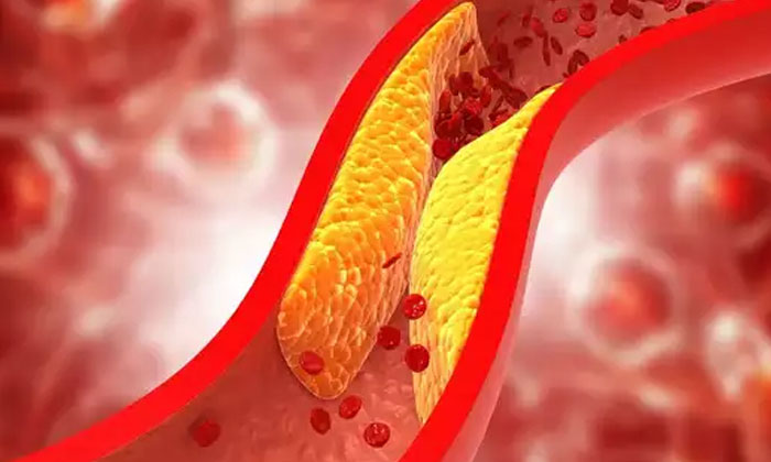 Telugu Cholesterol, Diabetes, Benefit, Tips, Heart, Hemoglobin, Pistachio-Telugu