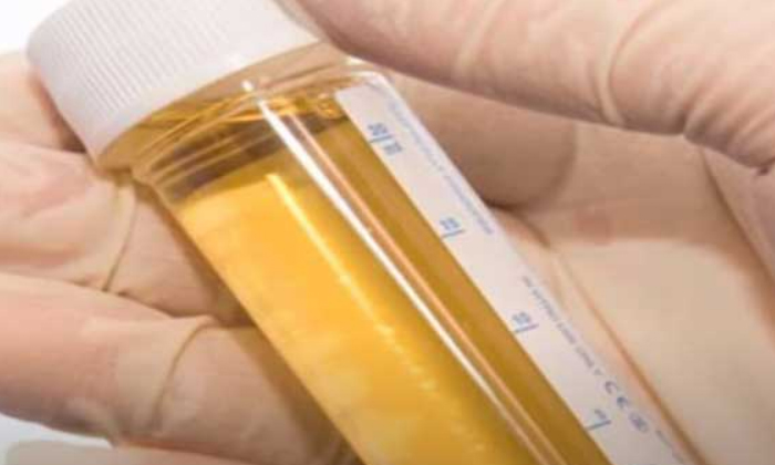  He Made The Doctors Surprised Urine Test Results In Just 2 Seconds , Doctors, Ur-TeluguStop.com