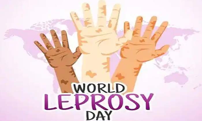  When Is World Leprosy Day Celebrated ,world Leprosy Day ,mahatma Gandhi's Death-TeluguStop.com