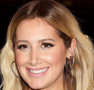  Ashley Tisdale Suffers From Alopecia-TeluguStop.com