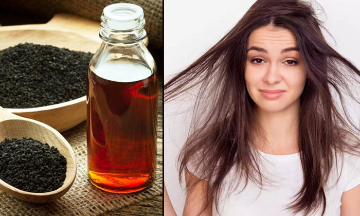 Telugu Dandruff, Care, Care Tips, Fall, Latest, Thick-Telugu Health