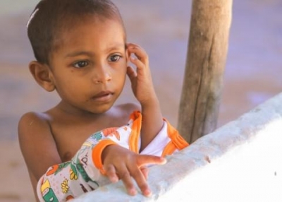  Malnutrition Rises Among Sri Lankan Kids Under 5: Health Minister-TeluguStop.com