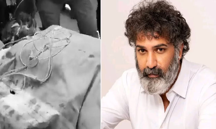 Symptoms Of Melena , Ntr , Tarakaratna, Balloon Angioplasty , Endoscopy Therap Symptoms Of Melena , Ntr , Tarakaratna, Balloon Angioplasty , Endoscopy Therap-TeluguStop.com