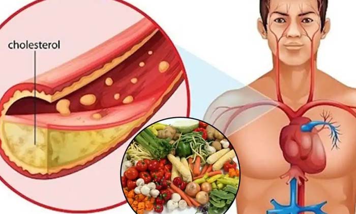  Are You Worried That Cholesterol In The Body Is Not Reducing But Do This ,choles-TeluguStop.com
