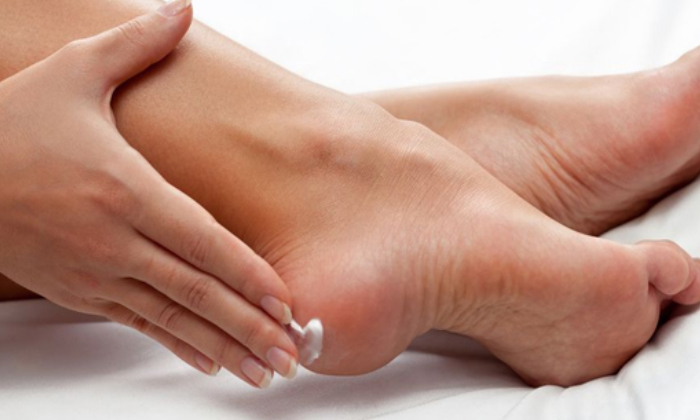  How To Prevent Cracked Heels With Onion Cracked Heels, Onion, Cracked Heels Trea-TeluguStop.com
