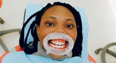  Everyday Tips For Healthy Gums-TeluguStop.com