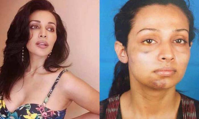  Flora Saini Alleged Famous Producer Hit My Private Parts ,flora Saini, Bollywood-TeluguStop.com