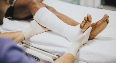 More Cases Of Fractures, Without Fall, Being Reported In Lucknow More Cases Of Fractures, Without Fall, Being Reported In Lucknow-TeluguStop.com