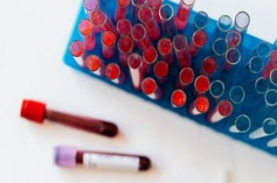  Screening Tests Postmenopausal Women Should Have-TeluguStop.com