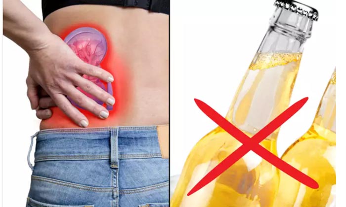  If You Drink Beer, Will The Stones In The Kidneys Dissolve Medical Experts Have-TeluguStop.com