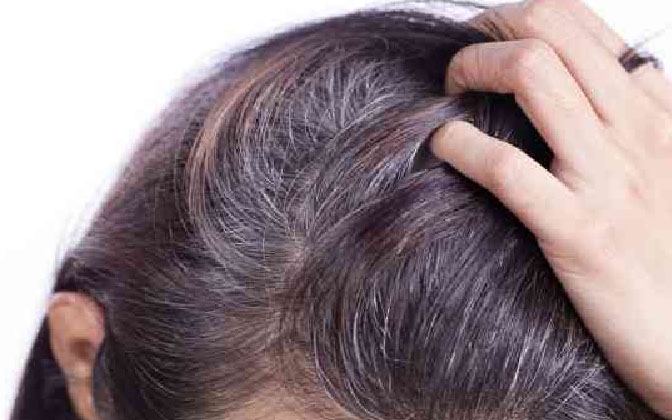  This Is An Effective Remedy To Control Hair Fall And White Hair! Hair Fall, Whit-TeluguStop.com