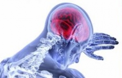  Brain Stroke Among Youngsters In India Doubled In Last Decade: Experts At Assoch-TeluguStop.com