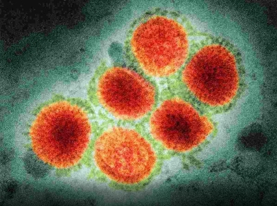  China Detects Another Human Case Of Influenza A H3n8-TeluguStop.com