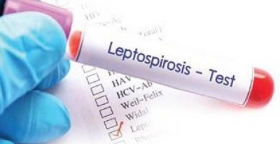  Leptospiroris Scare: Health Dept Orders For Temporary Closure Of Water Theme Par-TeluguStop.com