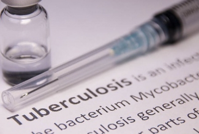  Tuberculosis Remains Key Cause Of Ill Health, Death In South Africa-TeluguStop.com