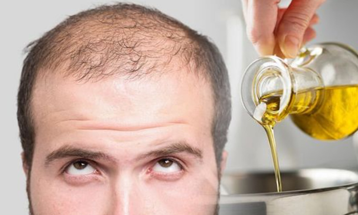  If You Use This Oil Twice A Week, You Will Not Get Baldness!, Baldness, Hair Oi-TeluguStop.com