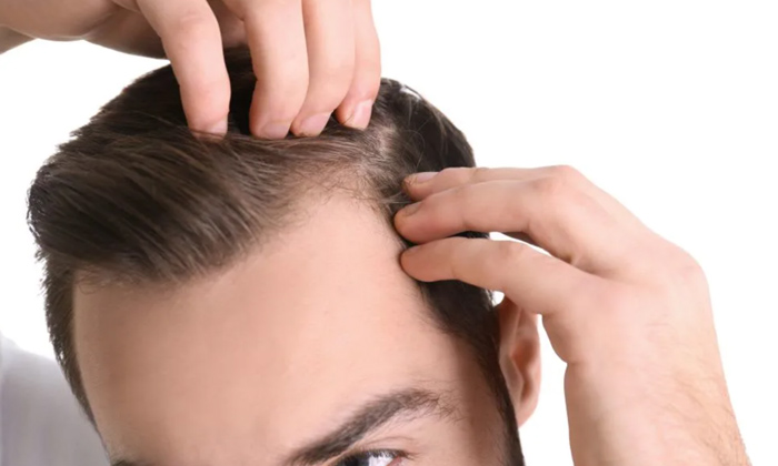 Telugu Baldness, Care, Care Tips, Oil, Thick-Telugu Health