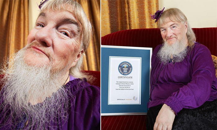 America Woman Creates Guinness World Record By Growing Beard Mustache Details, A America Woman Creates Guinness World Record By Growing Beard Mustache Details, A-TeluguStop.com