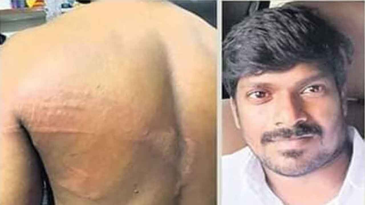  Ycp Activist Thrashed By Cops For Making Anti-mla Post-TeluguStop.com