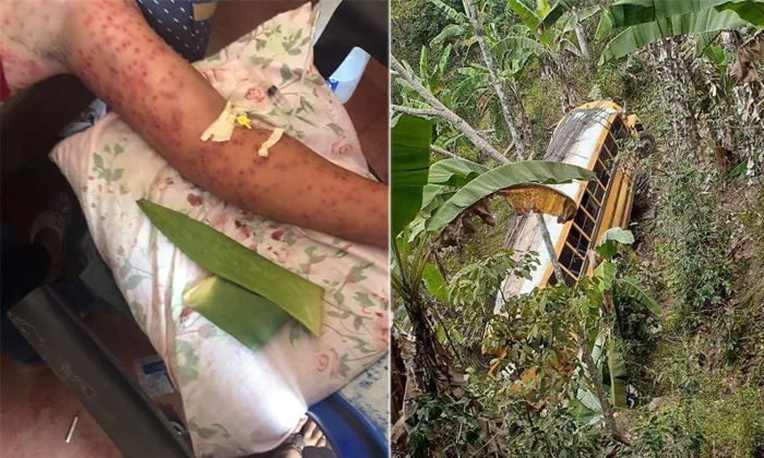  6 People Killed By Killer Bees After Bus Crashes Into Hives In Nicaragua Details-TeluguStop.com