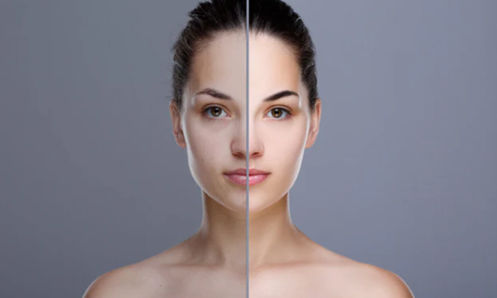 How To Repair Sun Tanned Skin At Home!, Sun Tanned Skin, Skin Care, Skin Care Ti-TeluguStop.com