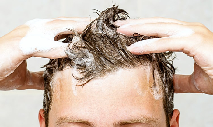  Shampooing In This Way Will Prevent Baldness Details! Baldness, Shampooing, Late-TeluguStop.com