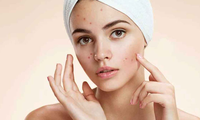 Telugu Tips, Face Cream, Latest, Skin Care, Skin Care Tips, Skin Tone, Skin Tone