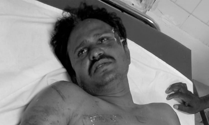  Tungathurthi Mla Followers Attacked The Advocate, Tungathurthi Mla Gadari Kishor-TeluguStop.com