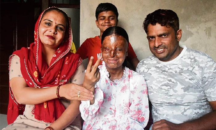 Telugu Acidattack, Cbse, Chandigarhblind, Haryana, Kafi, Kafi Tops Cbse-Latest N