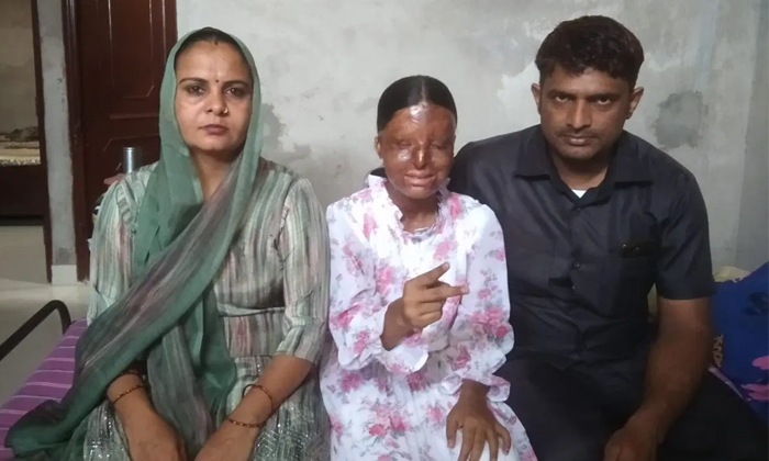  Acid Attack Survivor Kafi Tops-chandigarh Blind School Cbse Details, Acid Attack-TeluguStop.com