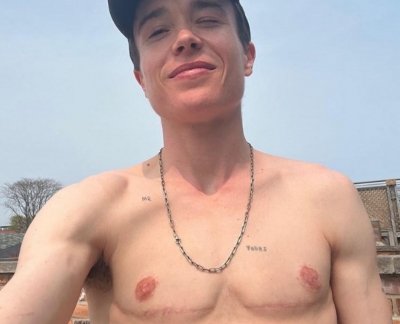  Elliot Page Celebrates His 'transjoy' With Topless Snap Showing Surgery Scars-TeluguStop.com