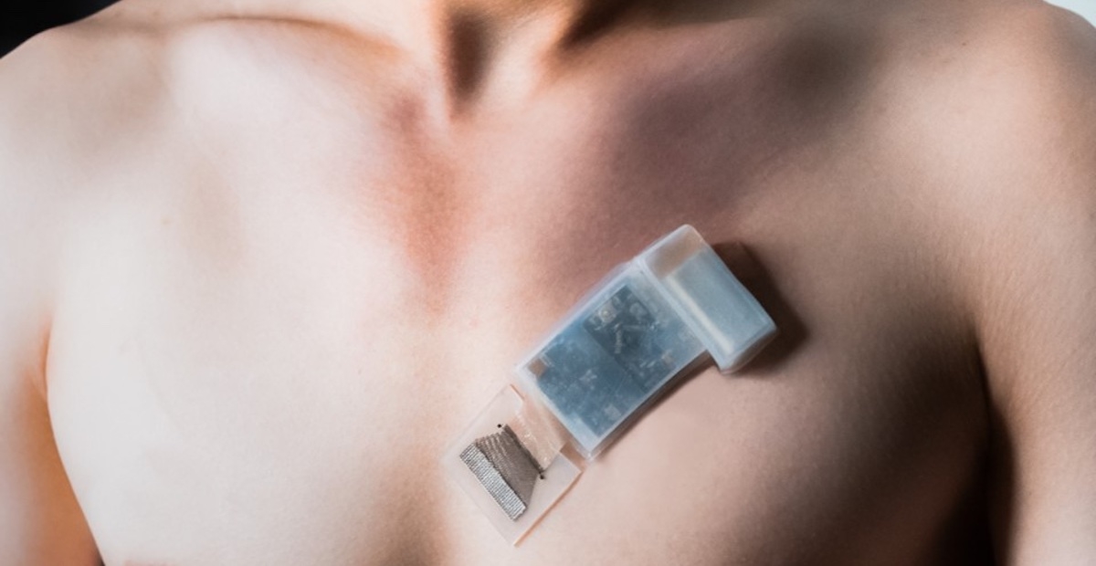  New Wearable Ultrasound System Can Monitor Bp, Heart Function On The Go-TeluguStop.com