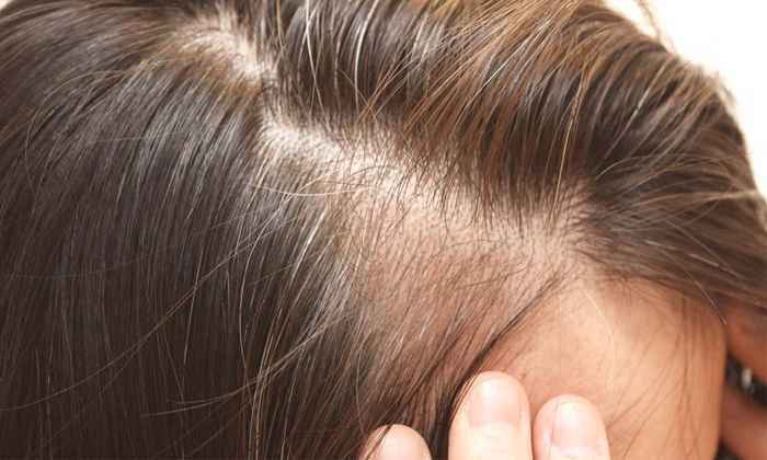  Effective Home Remedy For Getting Thick Hair Details! Home Remedy, Thick Hair, T-TeluguStop.com