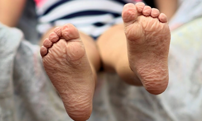 Telugu Tips, Hyperkeratosis, Keratin, Scientific, Telugu, Toes, Wrinkles-Telugu