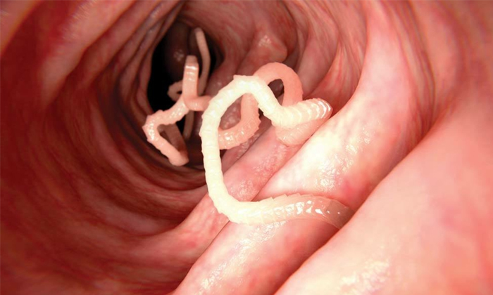 Telugu Lay Eggs, Diseases, Tips, Skin, Parasites, Professoradam, Tape Worms-Telu