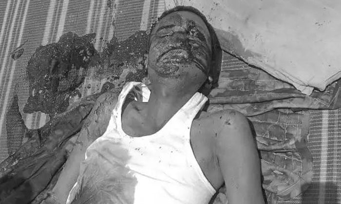  Atrocious In Nizamabad A Man Was Attacked By Huge Stone On His Head..! , Att-TeluguStop.com