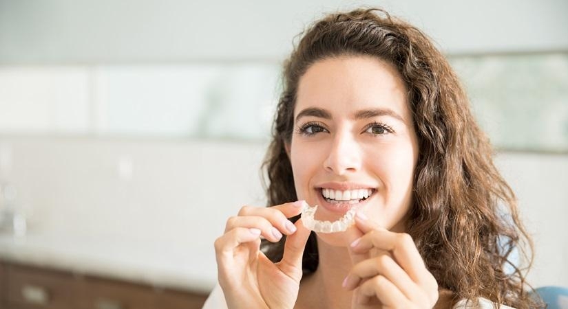  Busting Myths Around Aligners And Braces-TeluguStop.com