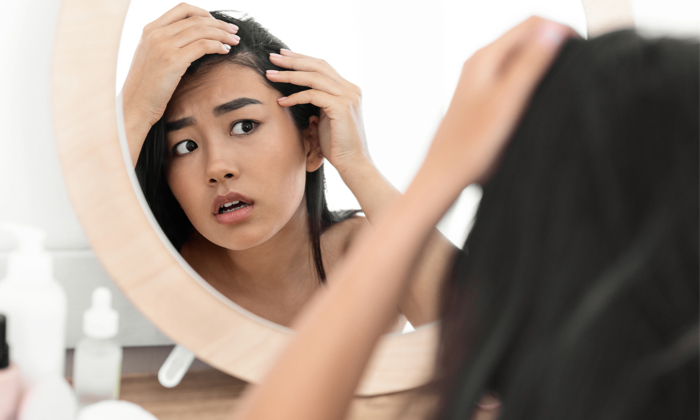  Powerful Remedy To Get Rid Of White Hair From Dandruff Details! Dandruff, White-TeluguStop.com