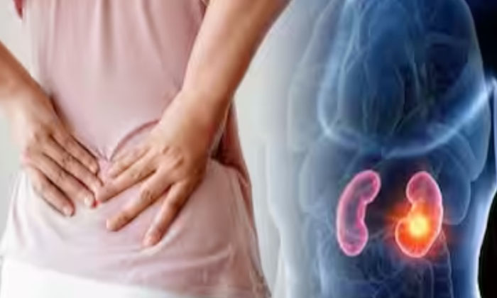 Telugu Tips, Kidneystone, Kidneys, Nephrolithiasis, Philadelphia, Stone Problems