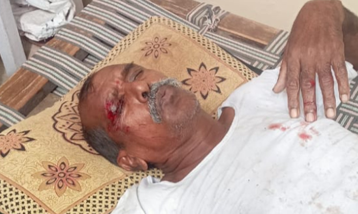  Injuries To Gita Worker Who Fell From Palm Tree In Rajanna Sircilla,rajanna Sirc-TeluguStop.com