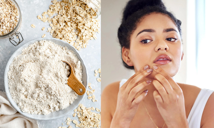  Oats Help To Get Rid Of Acne Naturally Details! Oats, Oats Benefits, Acne, Pimpl-TeluguStop.com